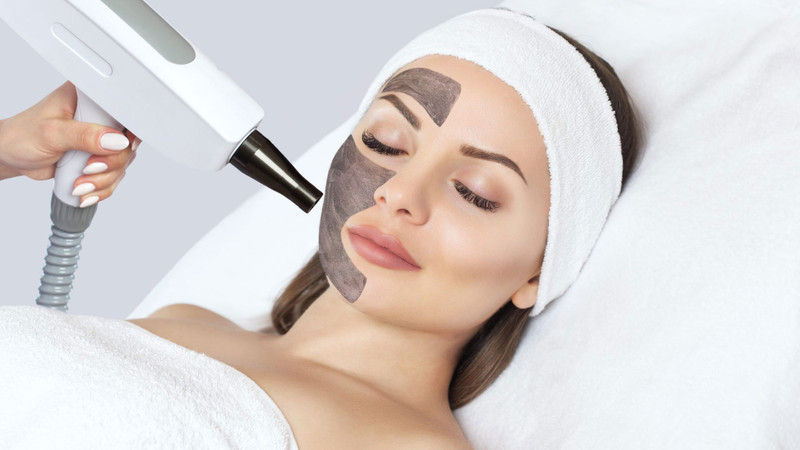 Hollywood Peel